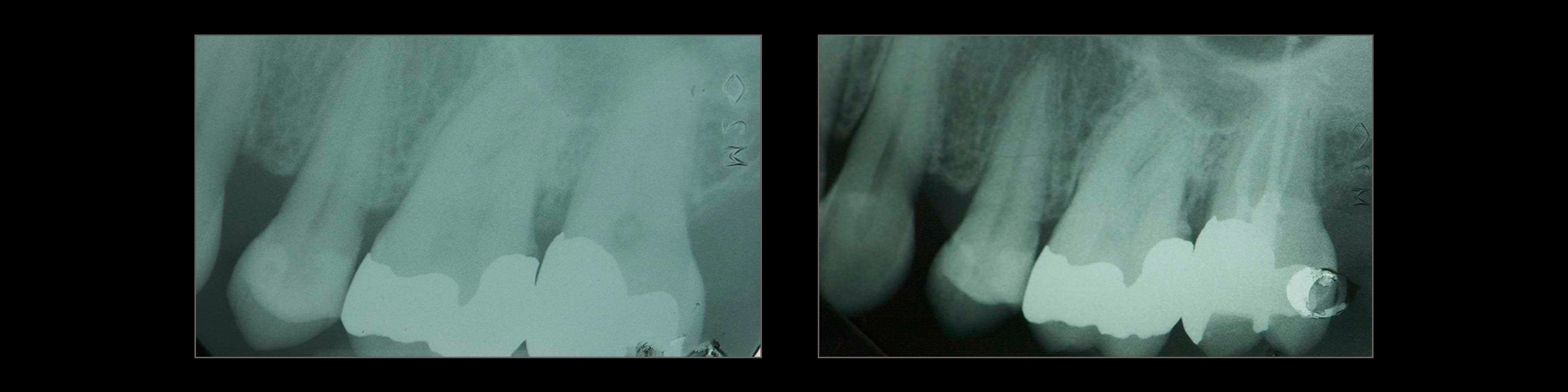 endodonzia_1