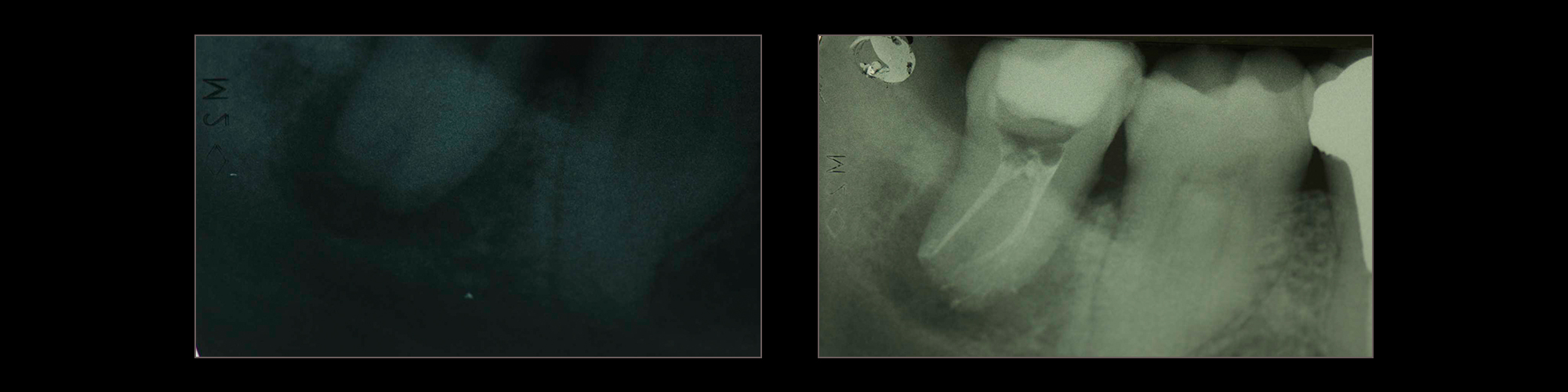 endodonzia_47